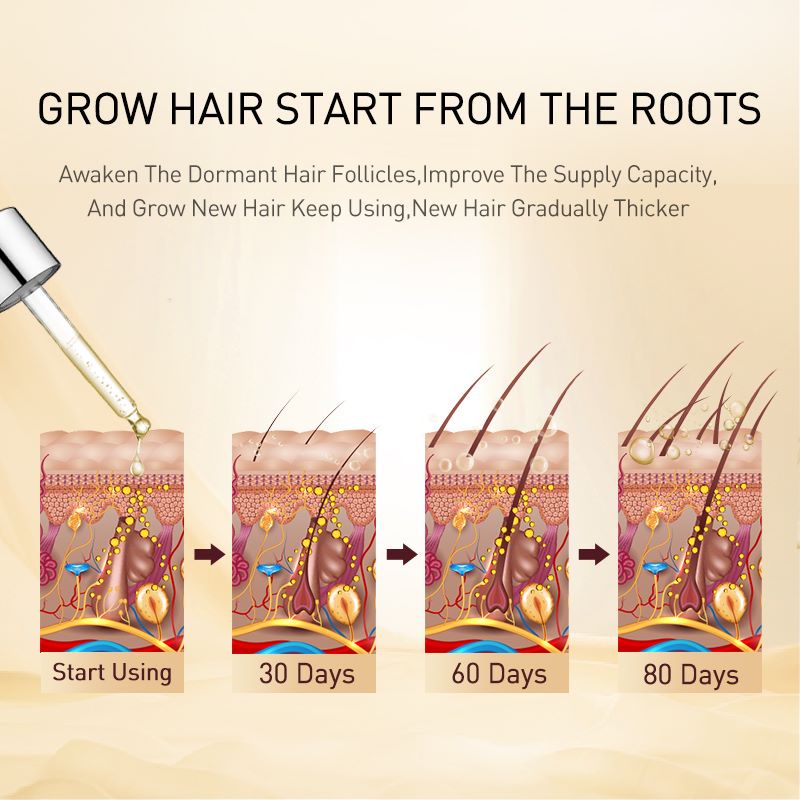 Ginger Hair Growth Oil for Thinning Hair 35ml by HitMyNeed