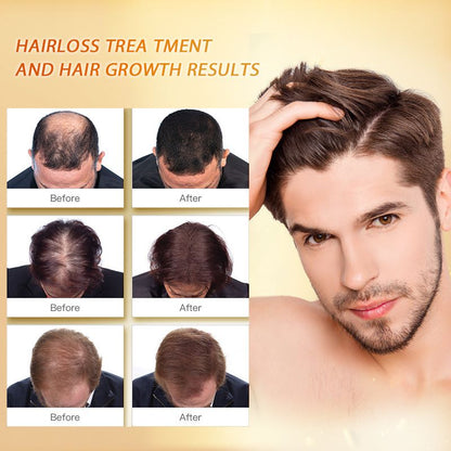 Ginger Hair Growth Oil for Thinning Hair 35ml by HitMyNeed