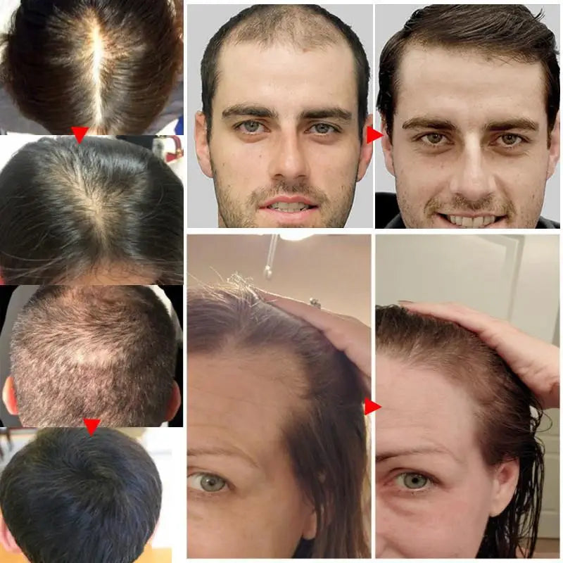 Ginger Hair Growth Serum for Thinning and Damaged Hair by HitMyNeed
