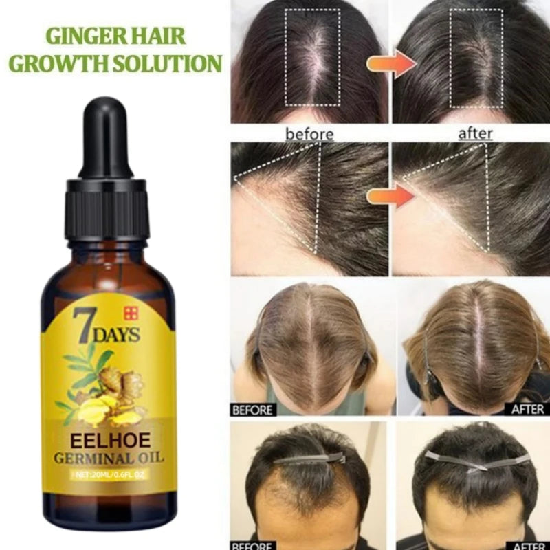 Ginger Hair Growth Serum for Thinning and Damaged Hair by HitMyNeed