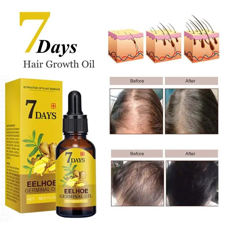 Ginger Hair Growth Serum for Thinning and Damaged Hair by HitMyNeed