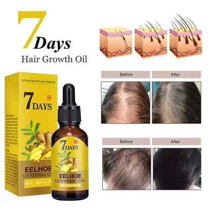 Ginger Hair Growth Serum for Thinning and Damaged Hair by HitMyNeed