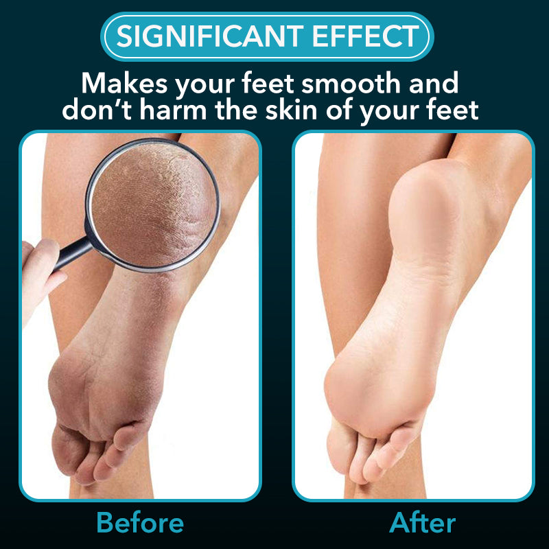 Glass Foot File Set for Callus & Dead Skin Removal by HitMyNeed