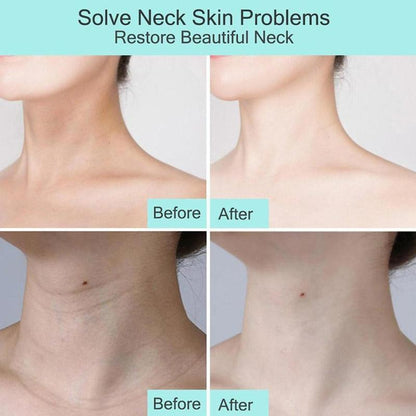 Goat Milk Collagen Neck Mask Firming & Hydrating by HitMyNeed