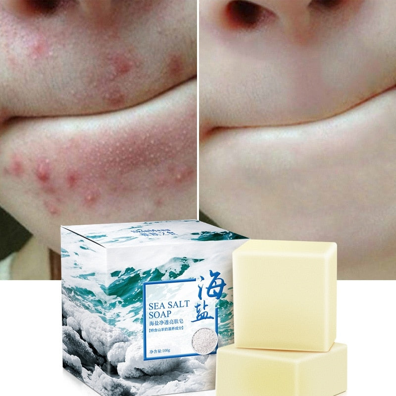 Goat Milk Sea Salt Facial Soap Bar 100g by HitMyNeed