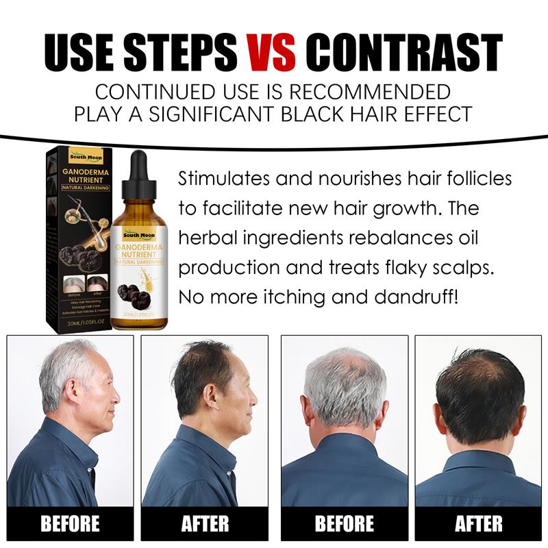 Gray Hair Treatment Serum for Natural Darker Tone 30ml by HitMyNeed