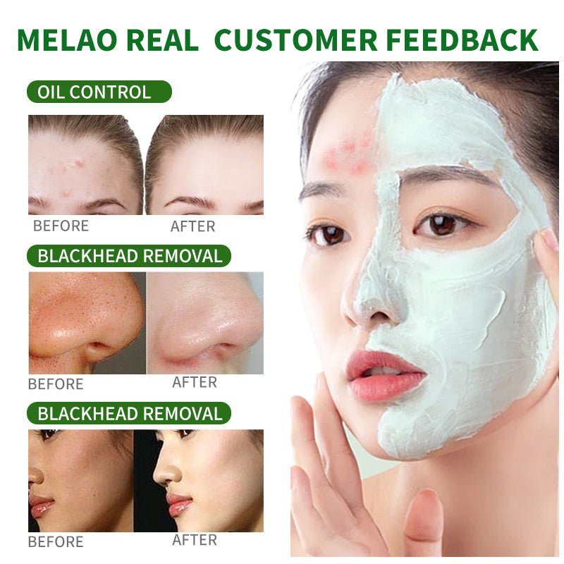 Green Tea Blackhead Remover Mask Stick 40g by HitMyNeed