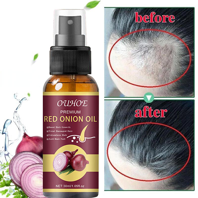 Growth Enhancer Onion Hair Serum 30ml by HitMyNeed