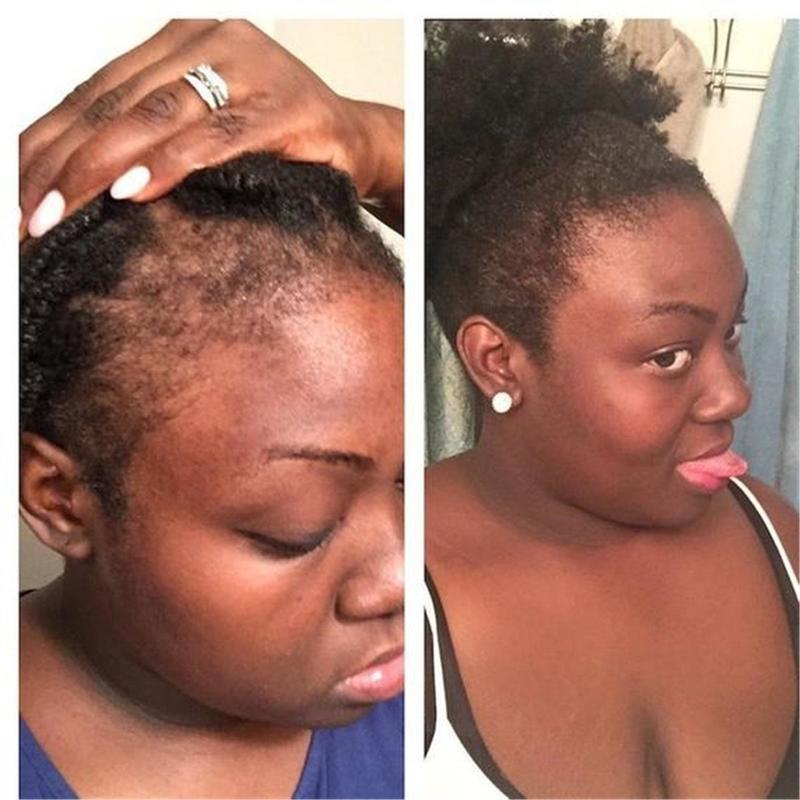 Growth Enhancer Onion Hair Serum 30ml by HitMyNeed