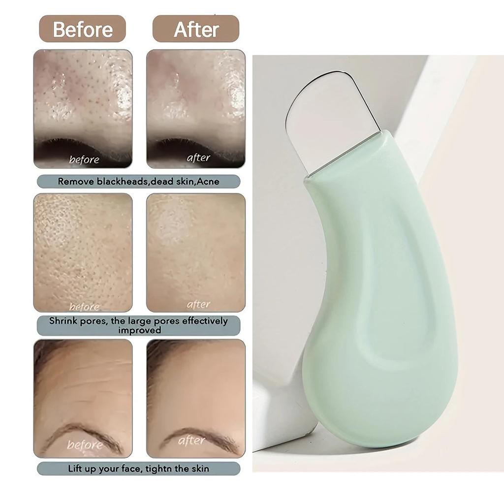 Handheld Blackhead Remover for Nose & Face Care by HitMyNeed
