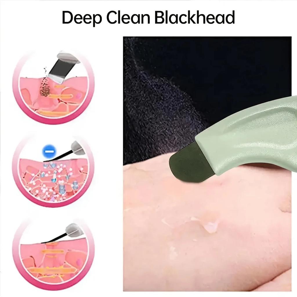 Handheld Blackhead Remover for Nose & Face Care by HitMyNeed