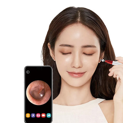 HD WiFi Ear Cleaning Otoscope with Camera by HitMyNeed