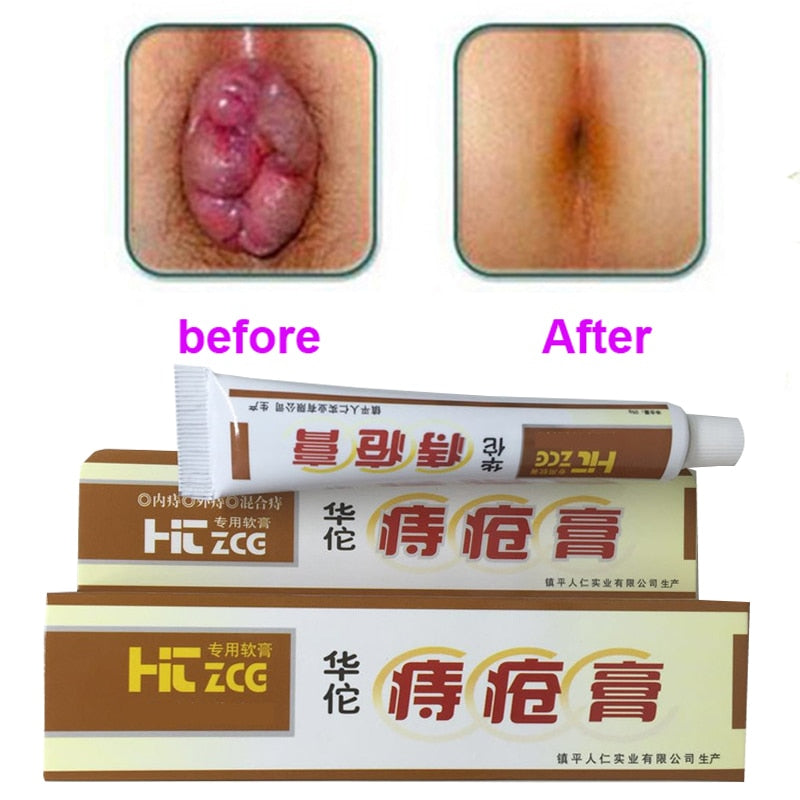 Hemorrhoid Soothing Ointment Cream 20g by HitMyNeed