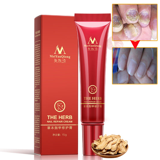 Herbal Antifungal Nail Treatment Cream 15g by HitMyNeed