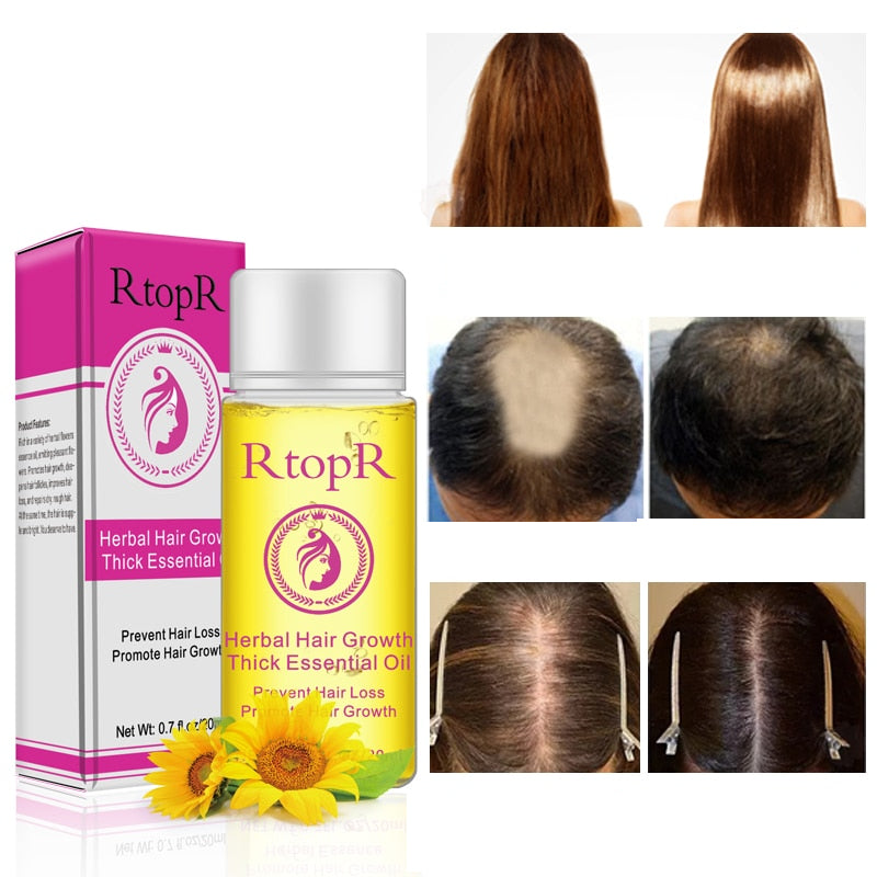 Herbal Hair Loss Treatment Serum 20ml by HitMyNeed