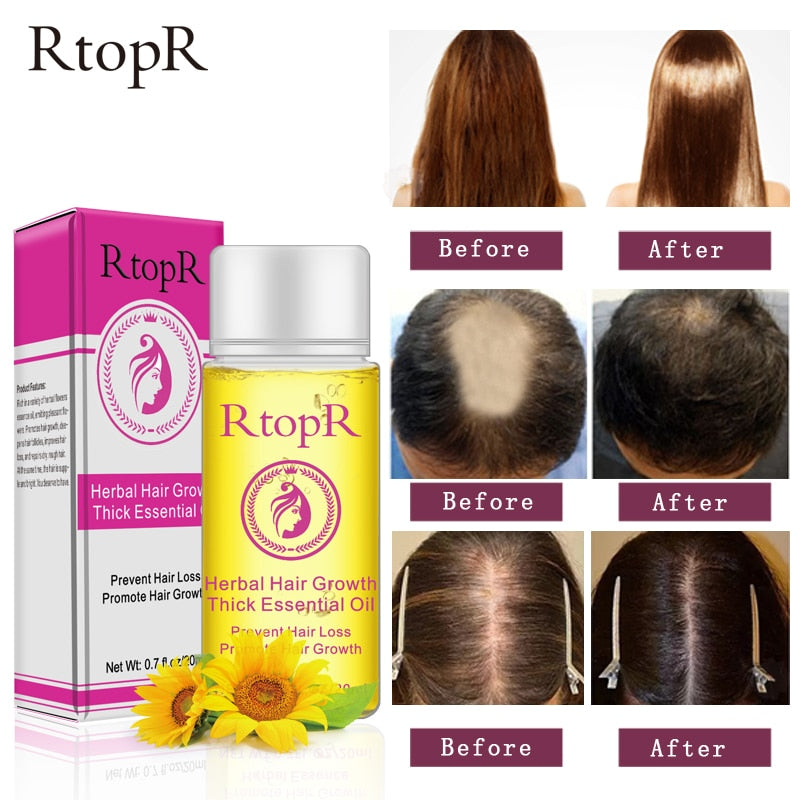 Herbal Hair Loss Treatment Serum 20ml by HitMyNeed