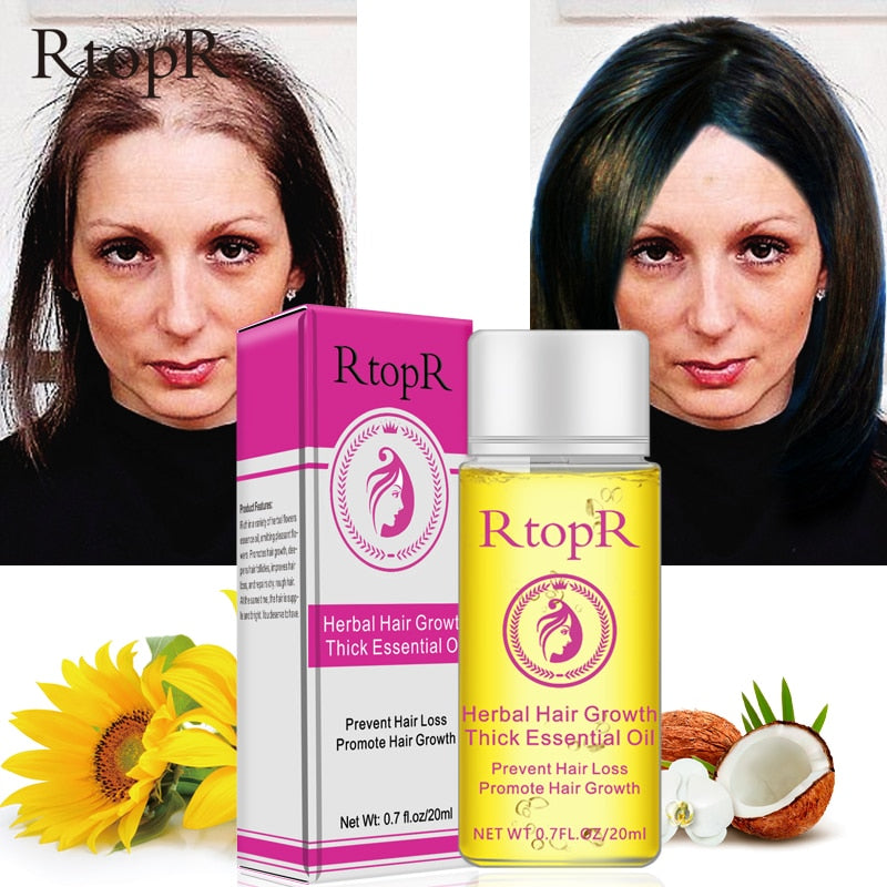 Herbal Hair Loss Treatment Serum 20ml by HitMyNeed