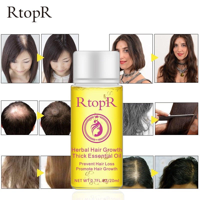 Herbal Hair Loss Treatment Serum 20ml by HitMyNeed