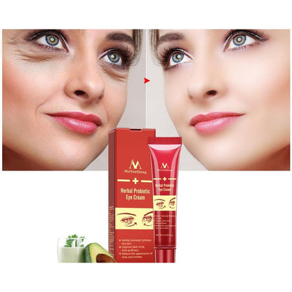Herbal Probiotic Eye Wrinkle Cream 15g by HitMyNeed