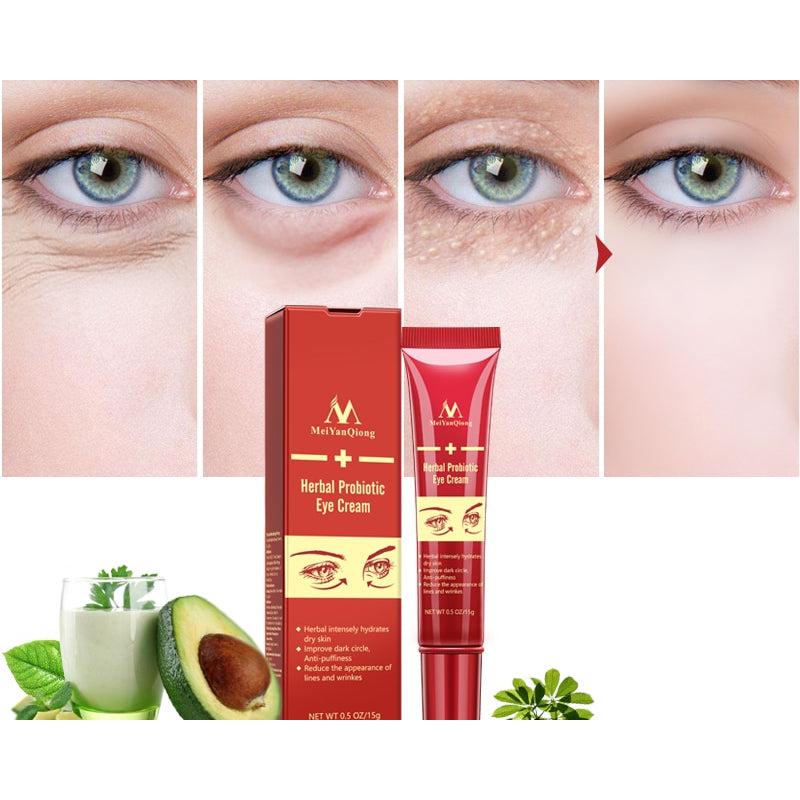 Herbal Probiotic Eye Wrinkle Cream 15g by HitMyNeed