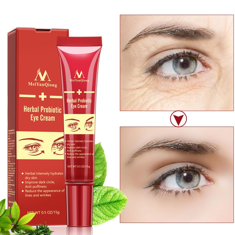 Herbal Probiotic Eye Wrinkle Cream 15g by HitMyNeed