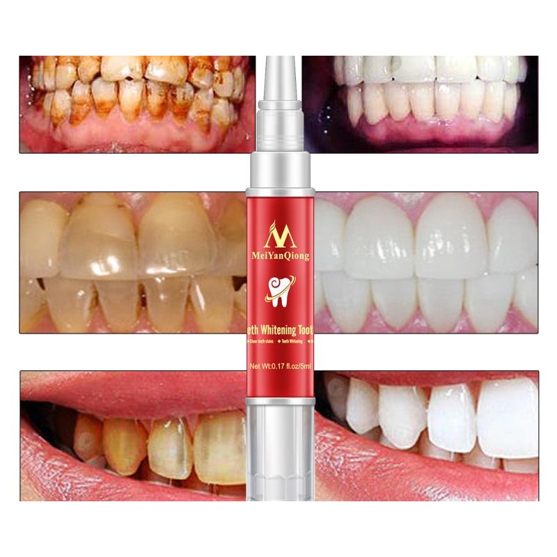 Herbal Teeth Whitening Toothbrush 5ml by MeiYanQiong by HitMyNeed