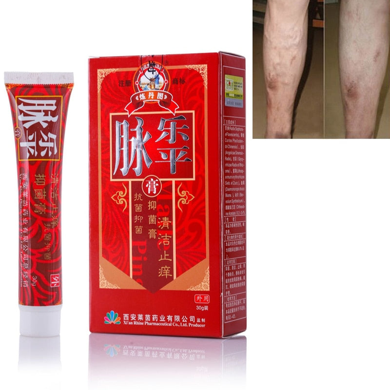 Herbal Varicose Vein Relief Cream 30ml by HitMyNeed