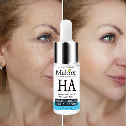 Hyaluronic Acid Facial Serum 15ml by HitMyNeed