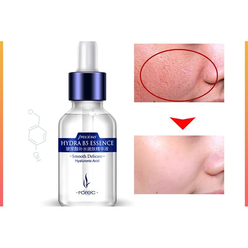 Hyaluronic Face Lifting Serum 15ml by HitMyNeed