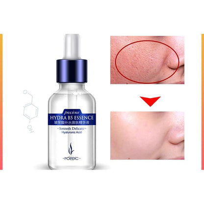Hyaluronic Face Lifting Serum 15ml by HitMyNeed