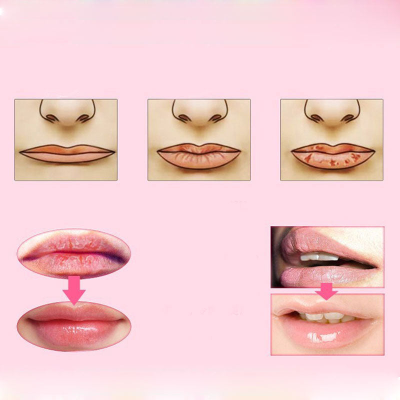 Hydrating Lip Mask Moisture Pads - Set of 5 by HitMyNeed