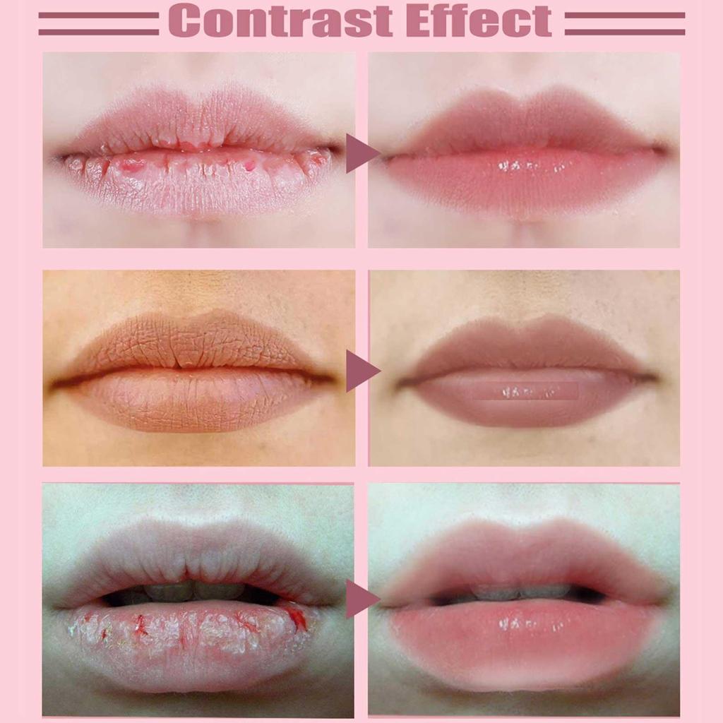Hydrating Lip Plumping Serum Balm 3ml by HitMyNeed