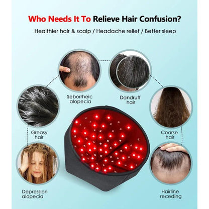 Infrared LED Hair Growth & Scalp Therapy Cap by HitMyNeed