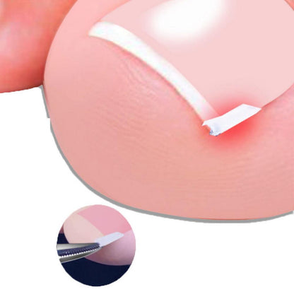 Ingrown Toenail Correction Elastic Patch Set, 10pcs by HitMyNeed