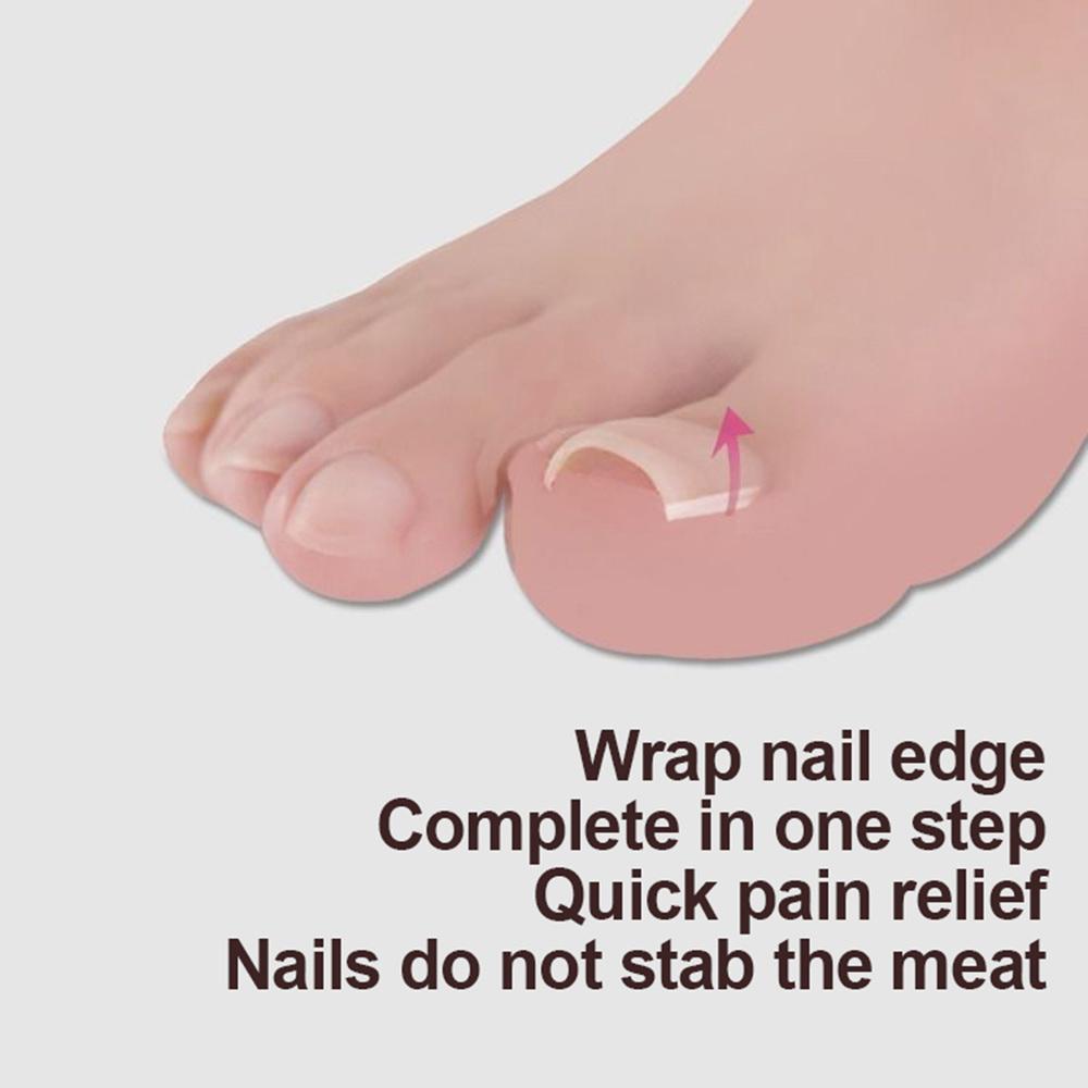 Ingrown Toenail Correction Elastic Patch Set, 10pcs by HitMyNeed
