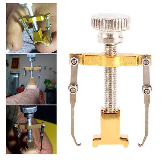 Ingrown Toenail Corrector and Lifter Tool by HitMyNeed