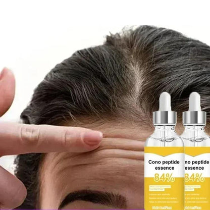 Instant Anti-Wrinkle Serum for Eyes, Face & Neck buy-3-get-2-free-5pcs by HitMyNeed