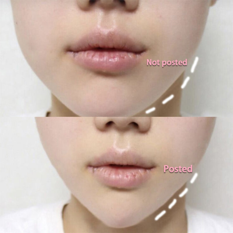 Instant Face Lift Tape with Adjustable Strings by HitMyNeed