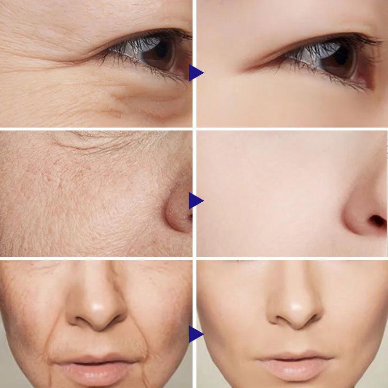 Instant Firming Anti-Aging Face & Neck Cream 15g by HitMyNeed