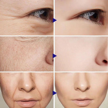 Instant Firming Anti-Aging Face & Neck Cream 15g by HitMyNeed