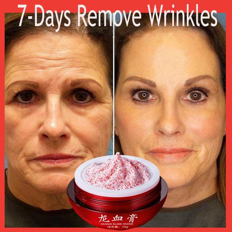 Instant Firming Anti-Aging Face & Neck Cream 15g by HitMyNeed