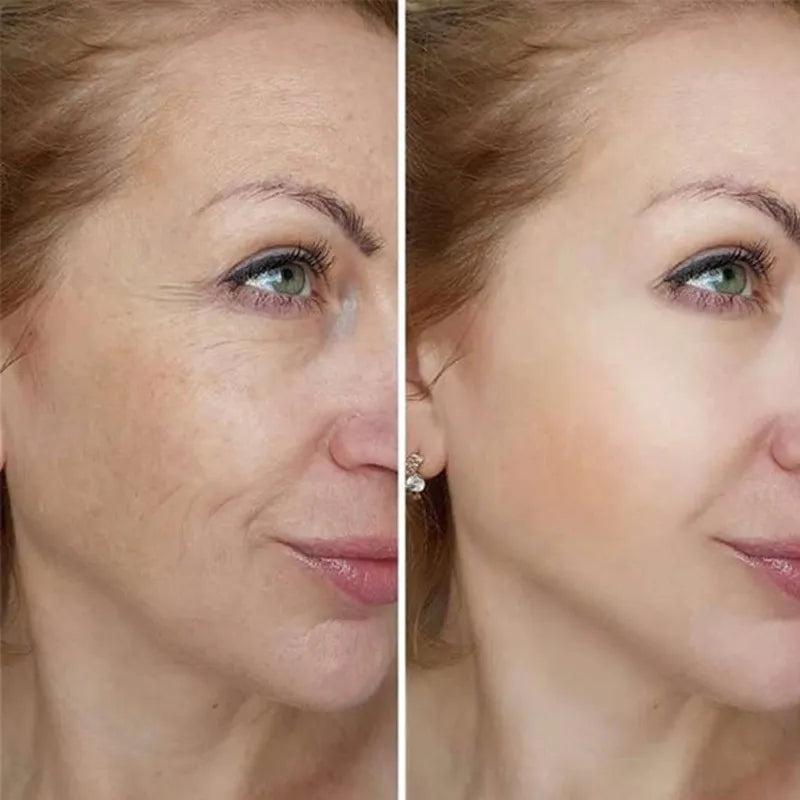 Instant Firming Anti-Aging Face & Neck Cream 15g by HitMyNeed