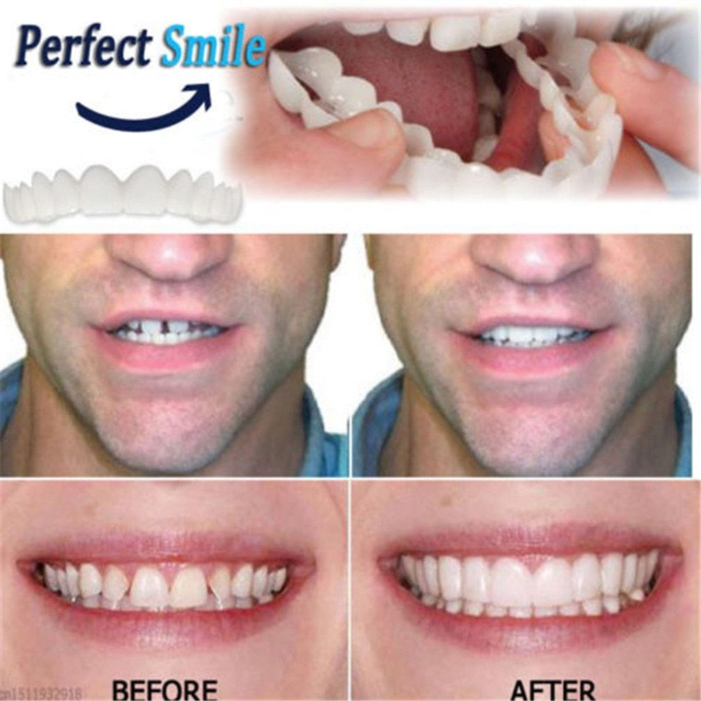 Instant Snap-On Fake Teeth for a Natural-Looking Smile by HitMyNeed