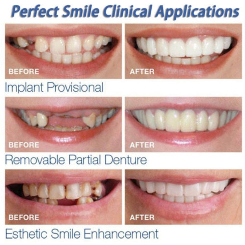Instant Snap-On Fake Teeth for a Natural-Looking Smile by HitMyNeed