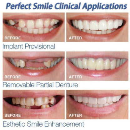 Instant Snap-On Fake Teeth for a Natural-Looking Smile by HitMyNeed