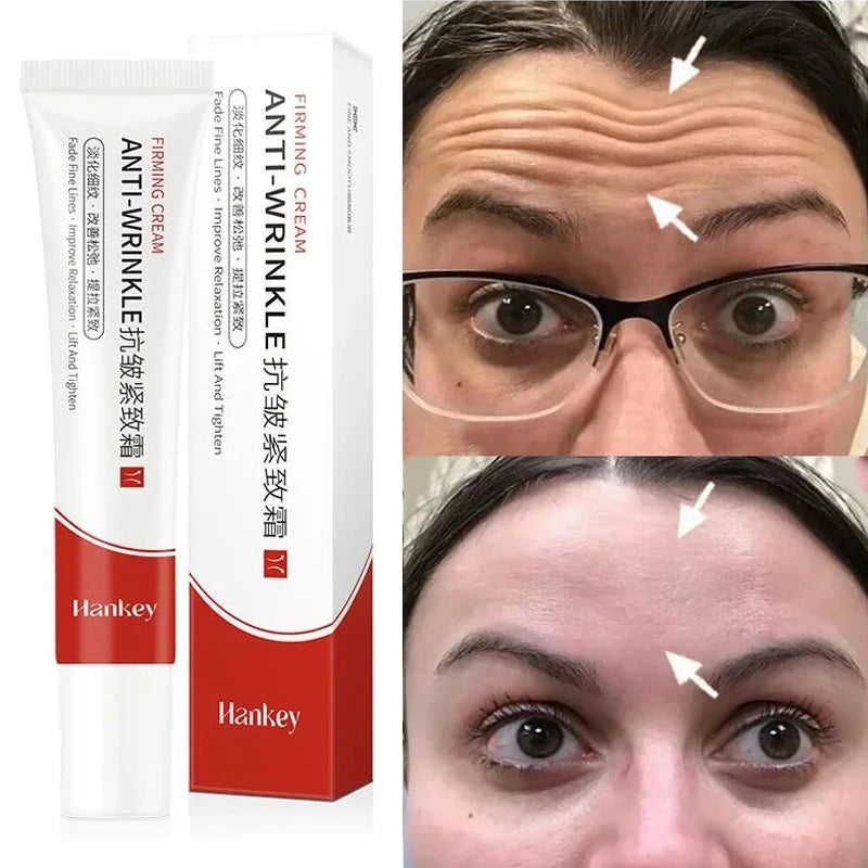 Instant Wrinkle Remover Retinol Face Cream by HitMyNeed