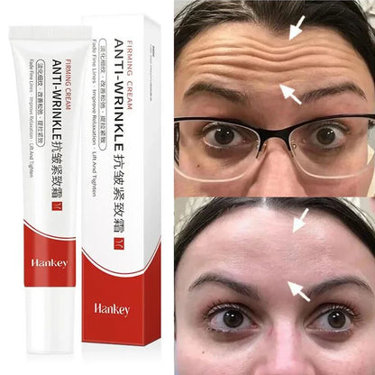 Instant Wrinkle Remover Retinol Face Cream by HitMyNeed