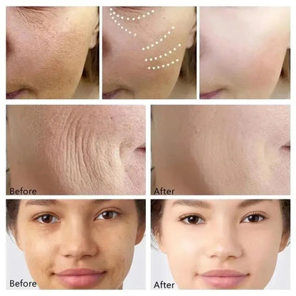 Instant Wrinkle Remover Retinol Face Cream by HitMyNeed