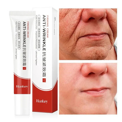 Instant Wrinkle Remover Retinol Face Cream by HitMyNeed