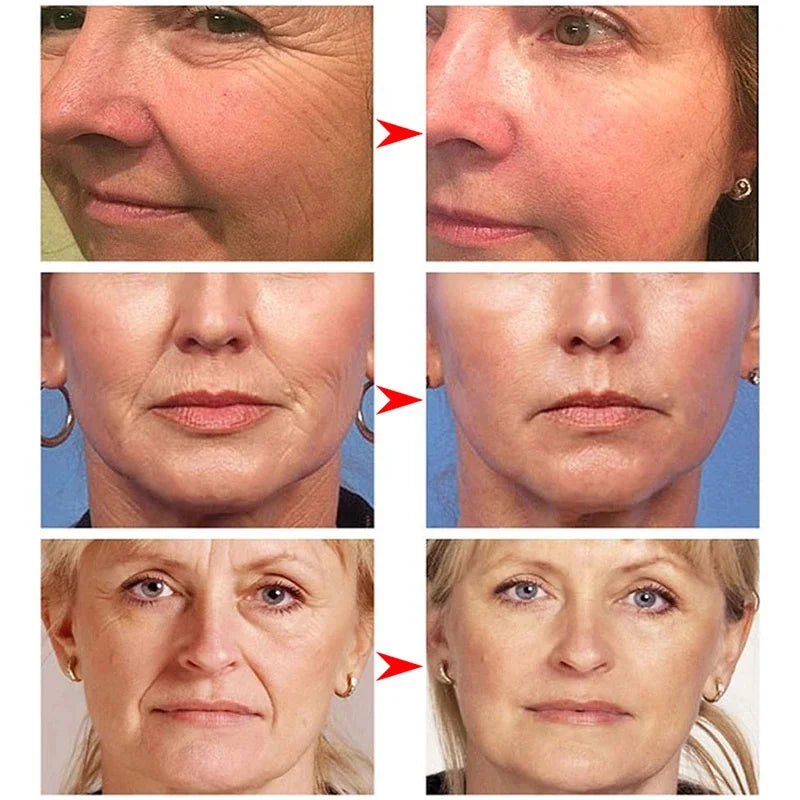 Instant Wrinkle Remover Retinol Face Cream by HitMyNeed